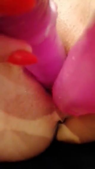 Ala11111