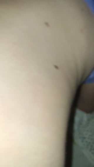 lewy12314